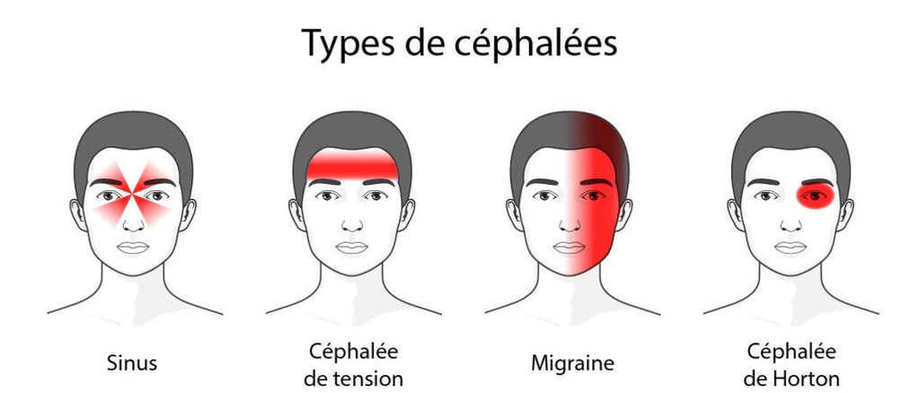 La migraine une souffrance Sénégalaise
